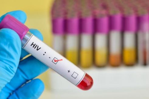 Hari AIDS Sedunia, Kenali Gejala HIV sejak Minggu Pertama Terinfeksi