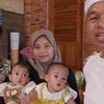 Bayi Kembar Siam Asal Tasikmalaya Akan Dioperasi, Dedi Mulyadi Tegaskan Operasi Tanpa Biaya