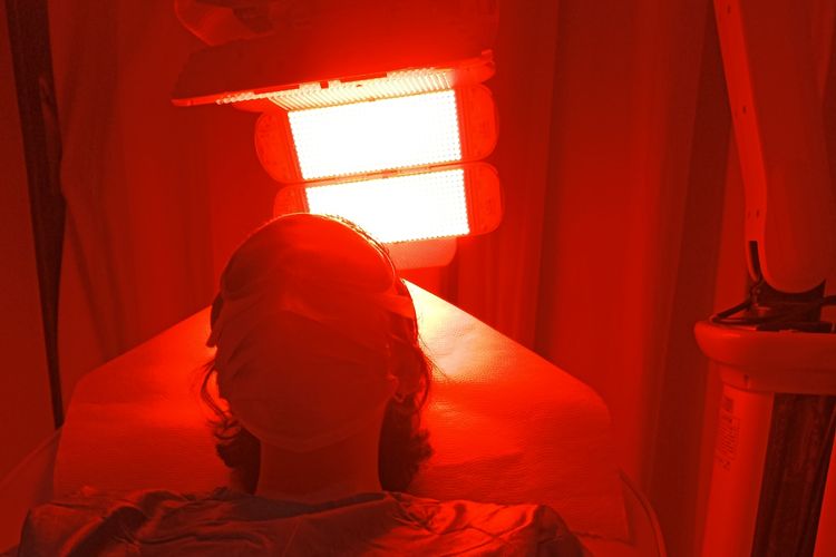 Red Light Therapy (RLT) adalah terapi rambut menggunakan sinar merah dengan panjang gelombang 633 nm berintensitas tinggi.