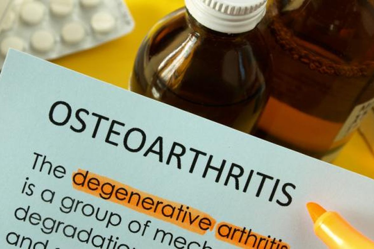 Ilustrasi osteoartritis