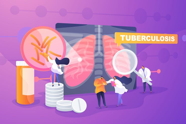 Ilustrasi TBC, tuberkulosis