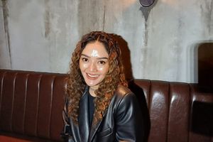 Ceritakan Awal Terkena Tumor Kelenjar Getah Bening, Siti Badriah: Awalnya Kecil Kayak Jerawat 