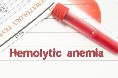 Anemia Hemolitik