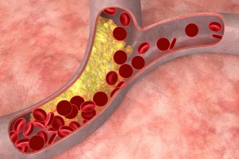 Pengertian dan Fungsi Pembuluh Arteri