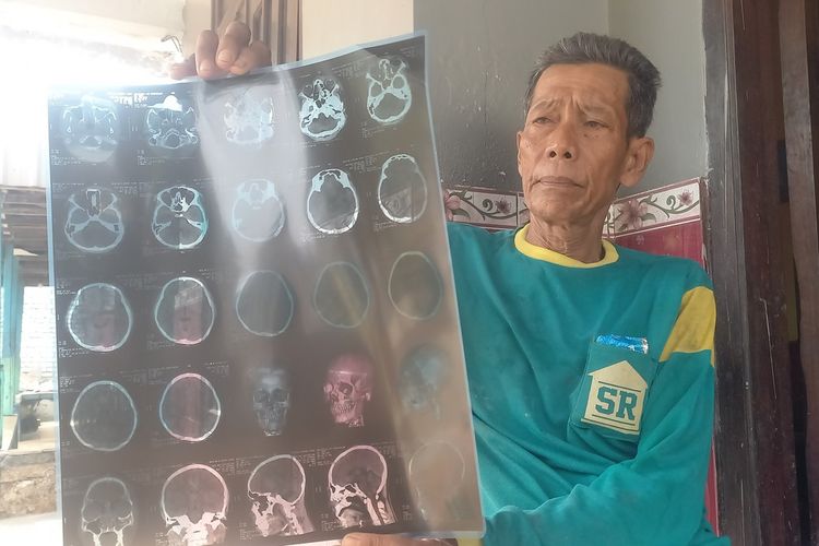 Suntoko menunjukkan hasil foto rontgent kepala cucunya berinisial ADS (16), yang menjadi korban tawuran saat menonton sepak bola antarpelajar Piala Bupati Tuban 2023). Selasa (7/11/2023).