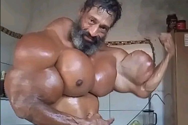Seorang binaragawan dan bintang Tik Tok dijuluki Hulk Brasil, berhasil memperoleh 1,6 juta pengikut dengan menyuntik minyak berbahaya ke tubuhnya sendiri untuk membuat bisep.