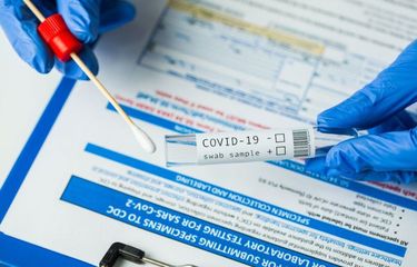 Ilustrasi rapid test antigen