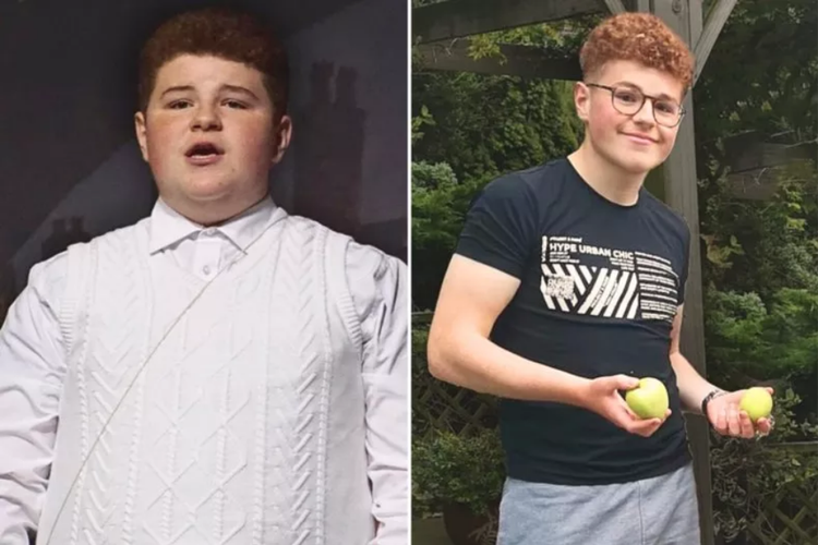 Tom Morley sebelum dan sesudah penurunan berat badan. 