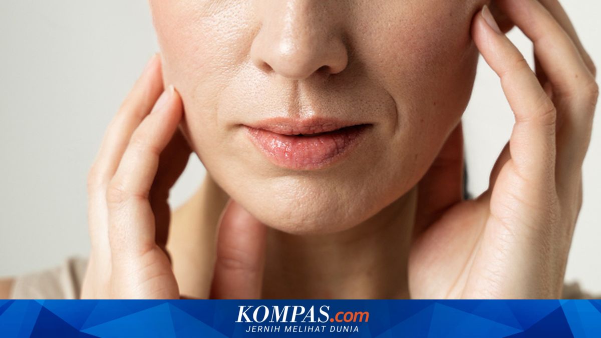 Mengapa Garis Senyum Muncul di Usia Muda? Simak Penjelasan Medisnya
