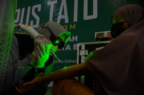 Ada Layanan Hapus Tato Gratis Sepanjang Ramadhan di Jakarta, Ini Cara Daftar dan Ketentuannya