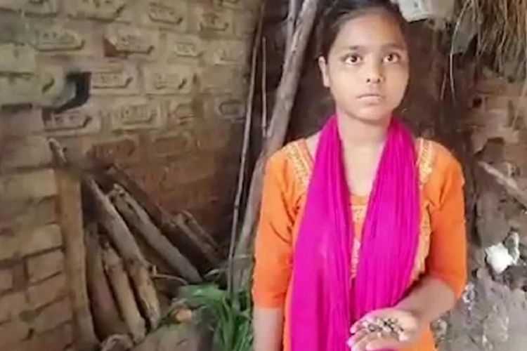 Chandhi, gadis 15 tahun di Negara Bagian Uttar Pradesh, India, yang menjadi viral karena mengeluarkan batu, alih-alih air mata, selama dua bulan terakhir.