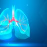 6 Macam Penyakit Paru-paru yang Harus Diwaspadai