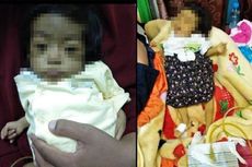 Fhatimah, Bayi 8 Bulan yang Divonis Serosis Hati, Badan Menguning, Tubuh Pakai Selang Urine