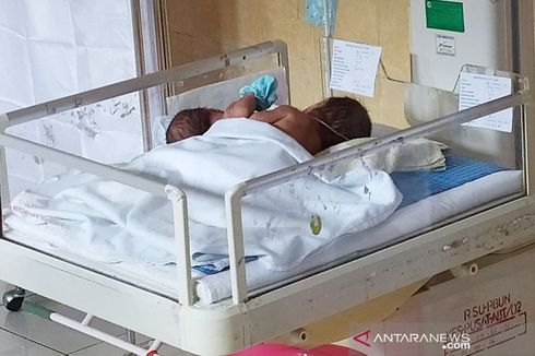 Tak Didampingi Keluarga, Ibu di Pangkalan Bun Lahirkan Bayi Kembar Siam Dempet Dada dan Perut