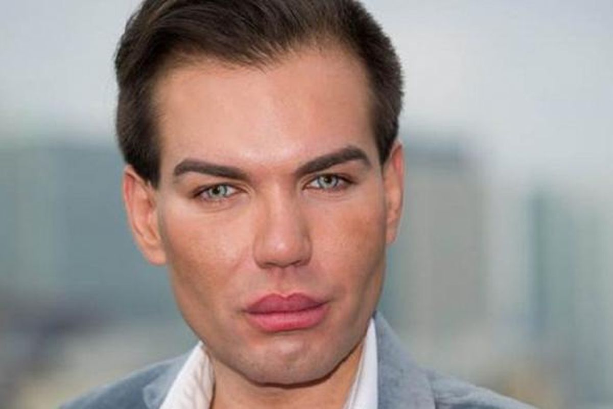 Rodrigo Alves, pria yang terobsesi menjadikan dirinya serupa dengan tokoh boneka Ken, kekasih boneka Barbie.