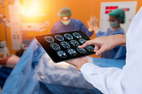 Pasien Tumor Otak Berhasil Dioperasi Minimal Invasif di Mayapada Hospital Bandung