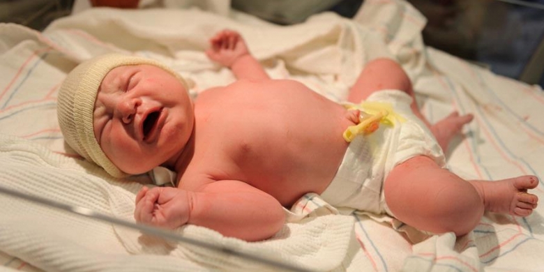 Ini Tujuan Tes Skor Apgar Bayi Baru Lahir Kilasdaerah Kompas Com