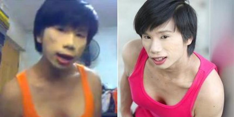 Gambar Usai Cangkok Payudara Pria Ini Merasa Jadi Korban Diskriminasi Usai Cangkok Payudara Pria Ini Merasa Jadi Korban Diskriminasi