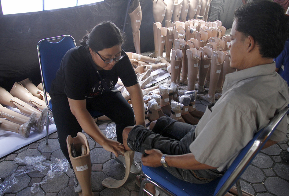 100 Penyandang Disabilitas di Aceh Dapat Bantuan Kaki dan Tangan